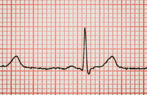 Puls messen in der Organisation